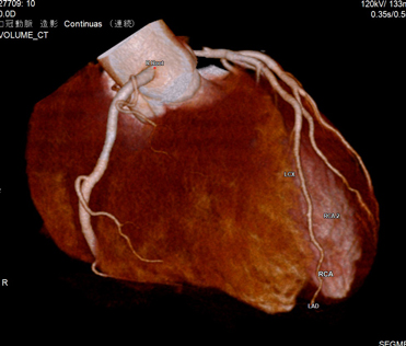 CT検査②
